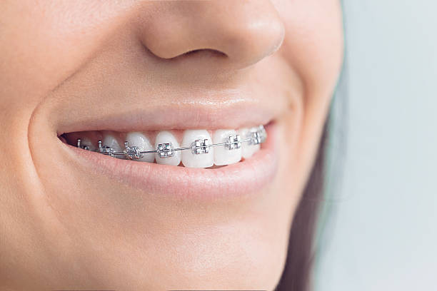 Best Preventive Dentistry  in Morse, LA